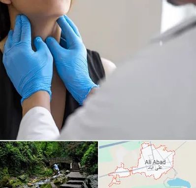 دکتر سرطان گلو در علی آباد کتول