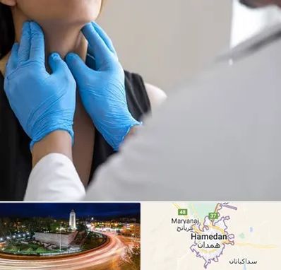 دکتر سرطان گلو در همدان