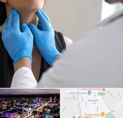 دکتر سرطان گلو در گلسار رشت 