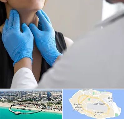 دکتر سرطان گلو در کیش
