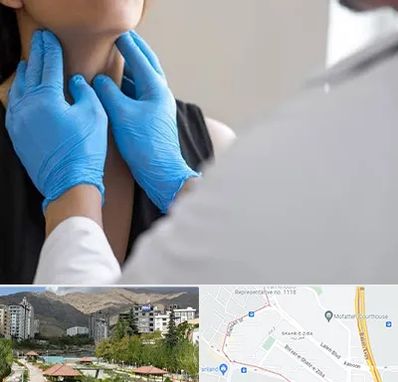 دکتر سرطان گلو در شهر زیبا 
