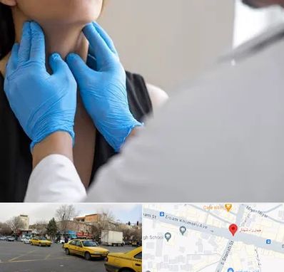 دکتر سرطان گلو در شهناز تبریز