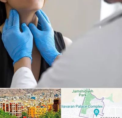 دکتر سرطان گلو در نیاوران 