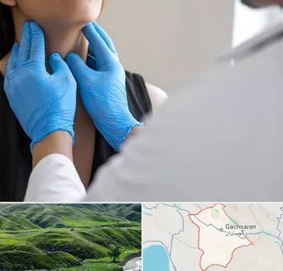 دکتر سرطان گلو در گچساران