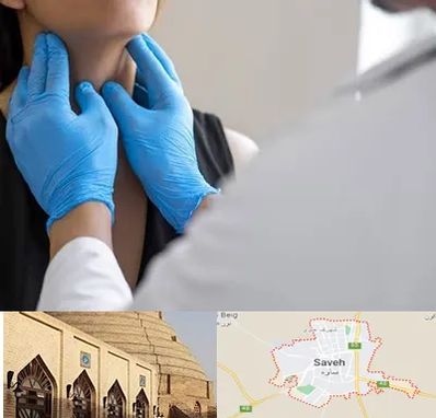 دکتر سرطان گلو در ساوه