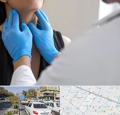 دکتر سرطان گلو در مفتح مشهد 