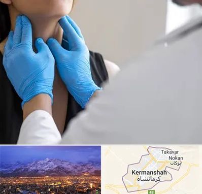 دکتر سرطان گلو در کرمانشاه