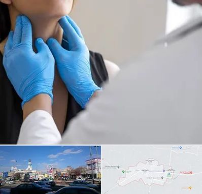 دکتر سرطان گلو در ماهدشت کرج 