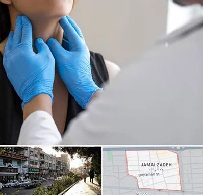 دکتر سرطان گلو در خیابان جمالزاده