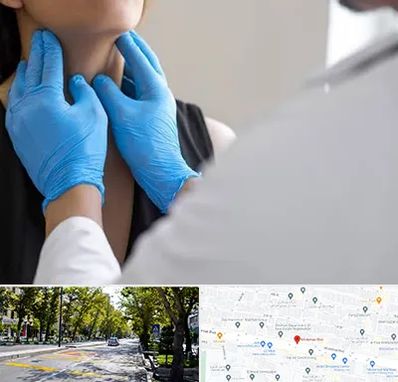 دکتر سرطان گلو در میرداماد 