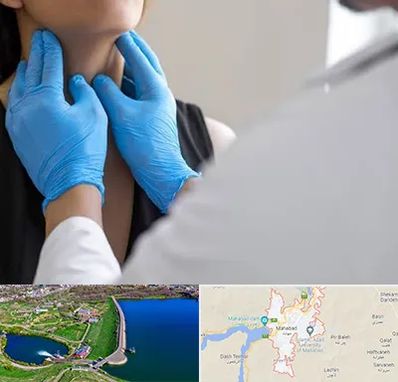 دکتر سرطان گلو در مهاباد