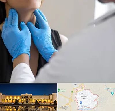 دکتر سرطان گلو در برازجان