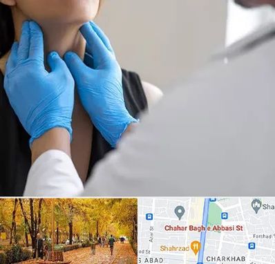 دکتر سرطان گلو در چهارباغ اصفهان 