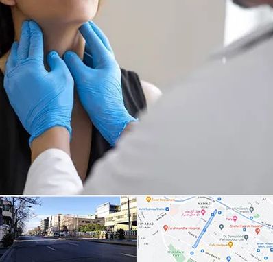 دکتر سرطان گلو در خیابان ملاصدرا شیراز 