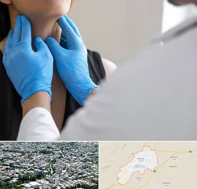 دکتر سرطان گلو در شاهرود