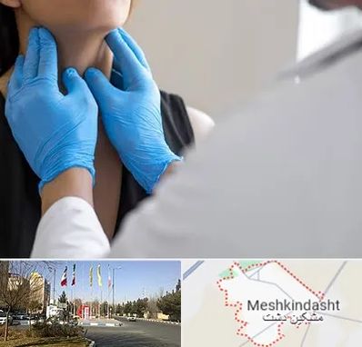 دکتر سرطان گلو در مشکین دشت