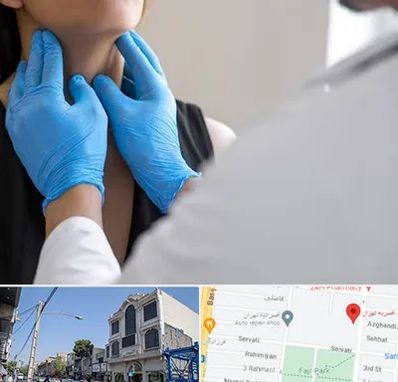 دکتر سرطان گلو در افسریه