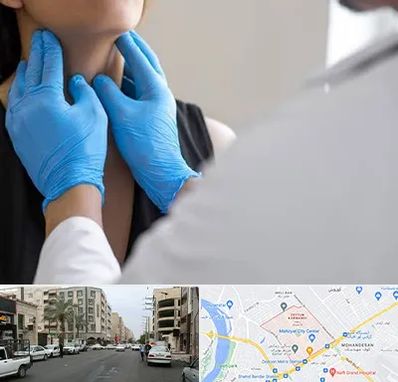 دکتر سرطان گلو در زیتون کارمندی اهواز 