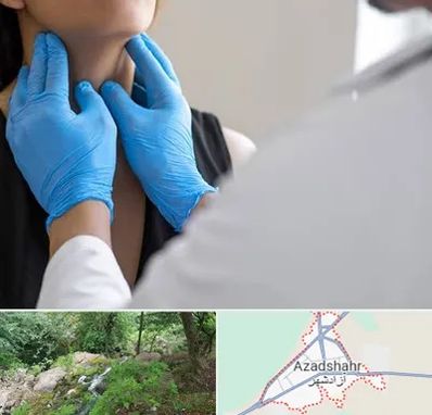 دکتر سرطان گلو در آزادشهر