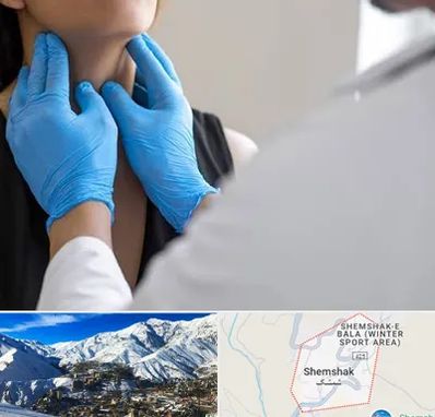دکتر سرطان گلو در شمشک
