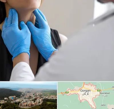 دکتر سرطان گلو در گرگان