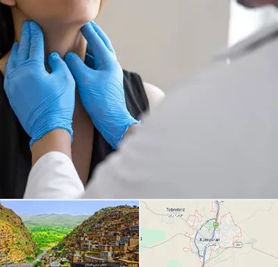 دکتر سرطان گلو در کامیاران