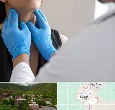 دکتر سرطان گلو در کلاله