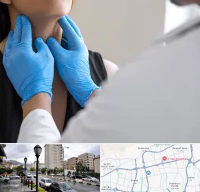 دکتر سرطان گلو در شمال غرب تهران