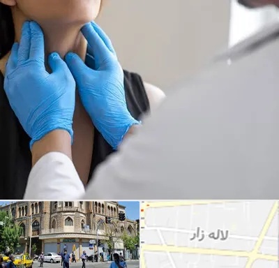 دکتر سرطان گلو در لاله زار