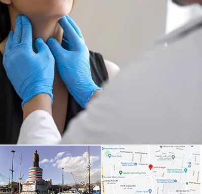 دکتر سرطان گلو در کارگر جنوبی 