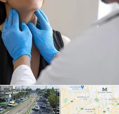 دکتر سرطان گلو در جنوب تهران 