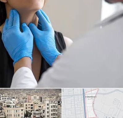 دکتر سرطان گلو در اسکندری