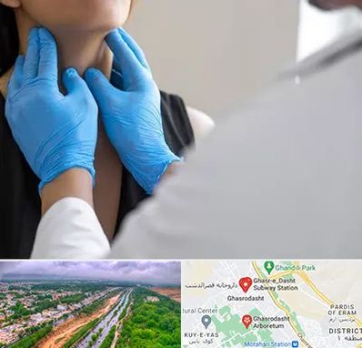 دکتر سرطان گلو در قصرالدشت شیراز 