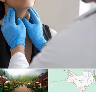 دکتر سرطان گلو در فومن