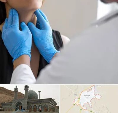 دکتر سرطان گلو در شهرضا