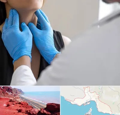 دکتر سرطان گلو در هرمزگان