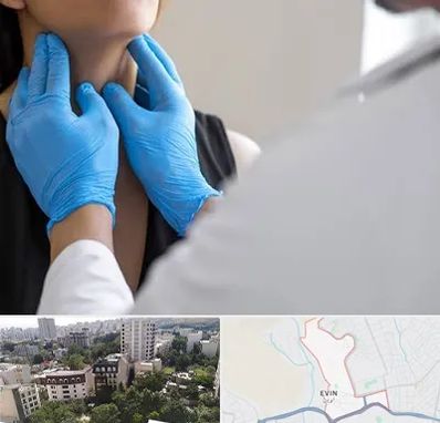 دکتر سرطان گلو در اوین