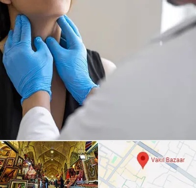 دکتر سرطان گلو در بازار وکیل شیراز