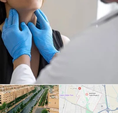 دکتر سرطان گلو در فاز سه اندیشه