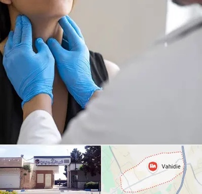 دکتر سرطان گلو در وحیدیه شهریار
