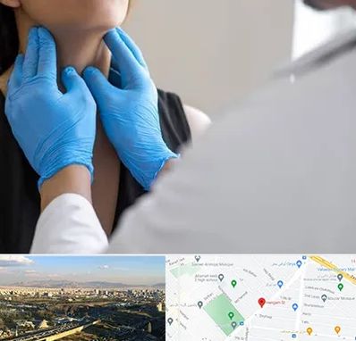 دکتر سرطان گلو در هنگام 