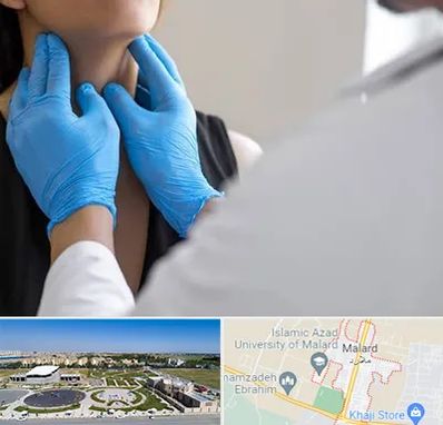 دکتر سرطان گلو در ملارد