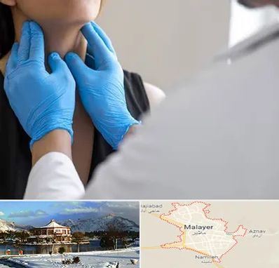 دکتر سرطان گلو در ملایر