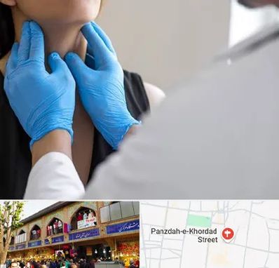 دکتر سرطان گلو در 15 خرداد