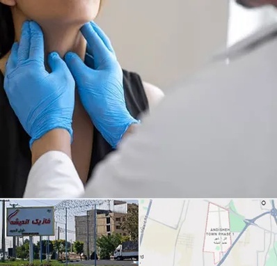 دکتر سرطان گلو در فاز یک اندیشه
