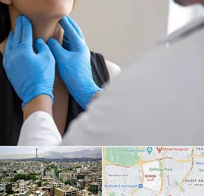 دکتر سرطان گلو در گیشا 
