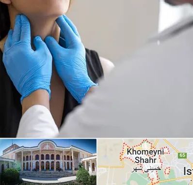 دکتر سرطان گلو در خمینی شهر