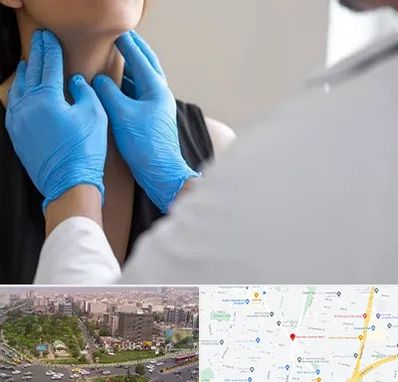 دکتر سرطان گلو در آیت الله کاشانی