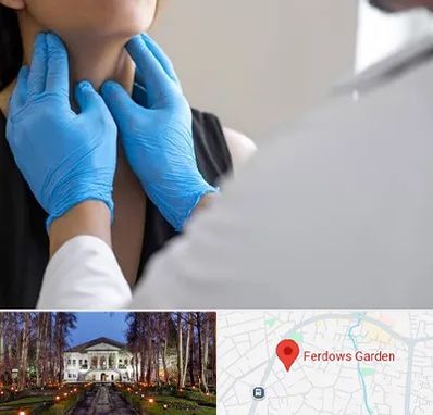 دکتر سرطان گلو در باغ فردوس