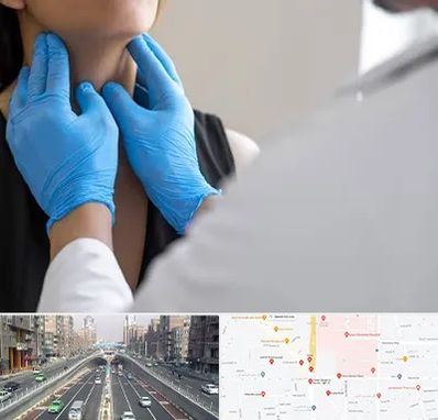 دکتر سرطان گلو در توحید 